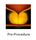 Before Urolife Procedure